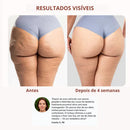 LipoFlow – Massageador Linfático para Lipedema e Celulite