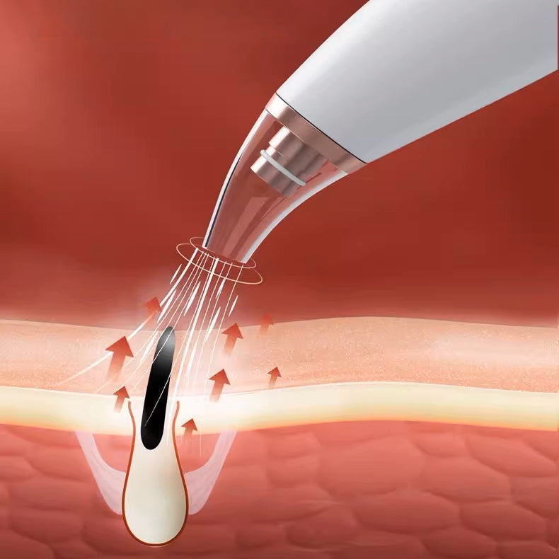 Removedor De Cravos Espinhas Usb Recarregável