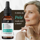 Sérum Clareador de Manchas Facial