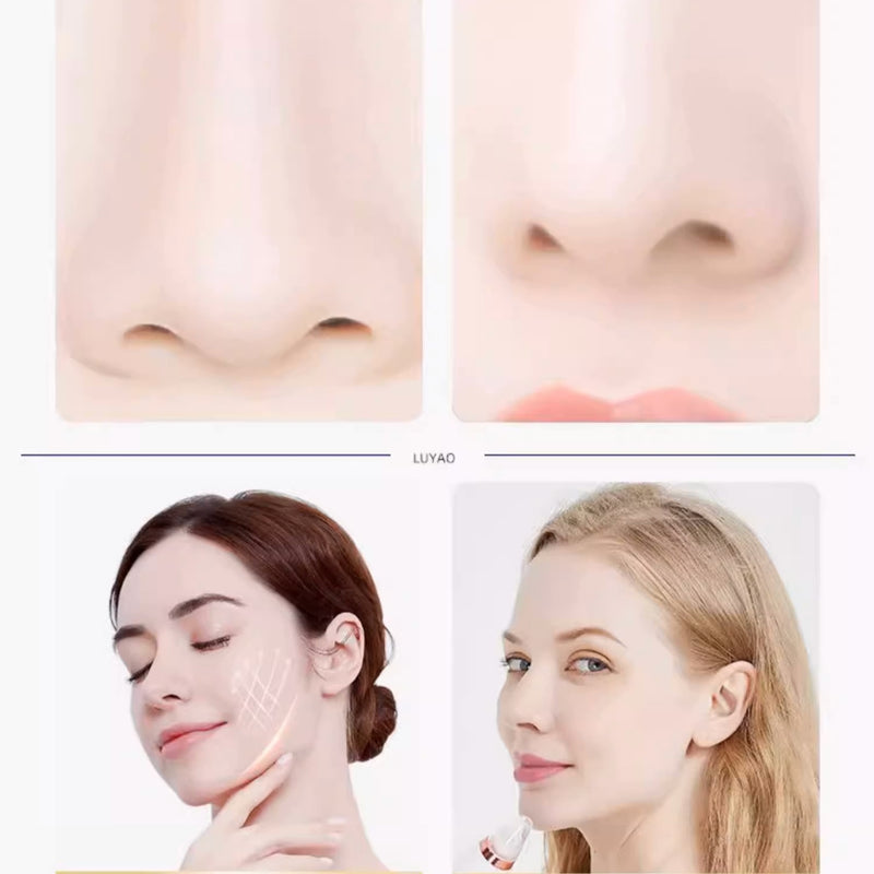 Removedor De Cravos Espinhas Usb Recarregável