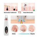 Removedor De Cravos Espinhas Usb Recarregável